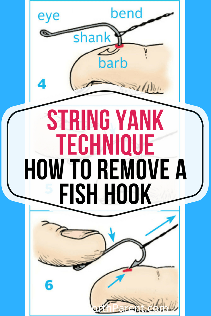The-String-Yank-Technique-_-How-to-Remove-a-Fish-Hook-if-Youre-Caught-in-the-Fishing-Fun-1.png