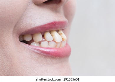 tooth-ugly-background-healthy-260nw-291355601.jpg
